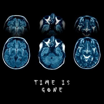 Time is Gone