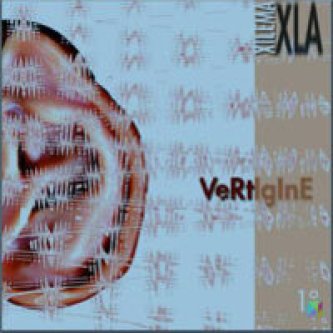 Vertigine