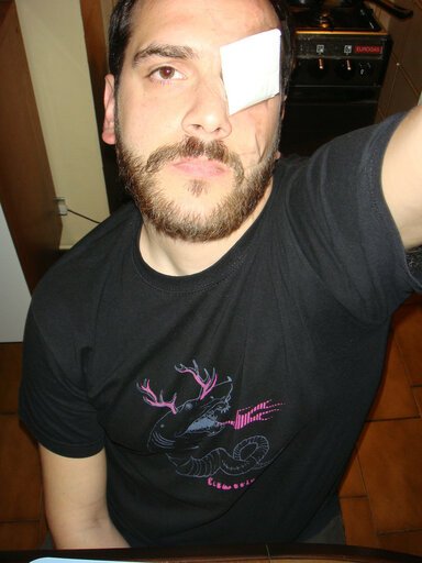 brace insiste........